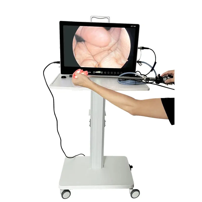 Surgery HD Endoscope Camera System I All-in-One Solution for Laparoscopy and Hysteroscopy Procedures