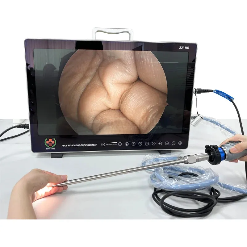 Surgery HD Endoscope Camera System I All-in-One Solution for Laparoscopy and Hysteroscopy Procedures