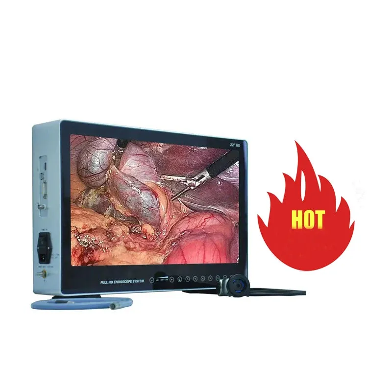 Surgery HD Endoscope Camera System I All-in-One Solution for Laparoscopy and Hysteroscopy Procedures