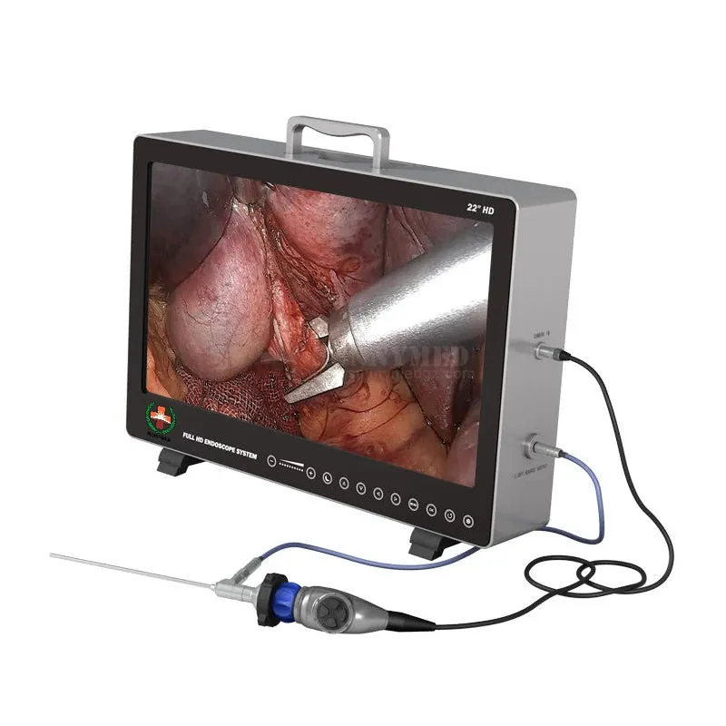 Surgery HD Endoscope Camera System I All-in-One Solution for Laparoscopy and Hysteroscopy Procedures